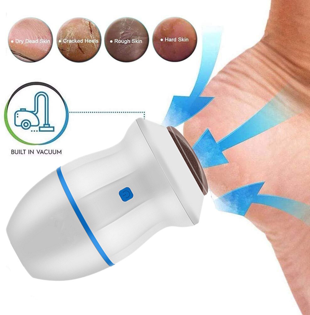 Electric Foot Callus Remover - NUWELLTH