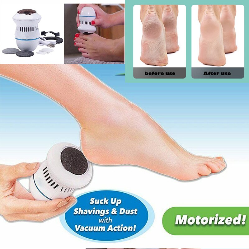 Electric Foot Callus Remover - NUWELLTH