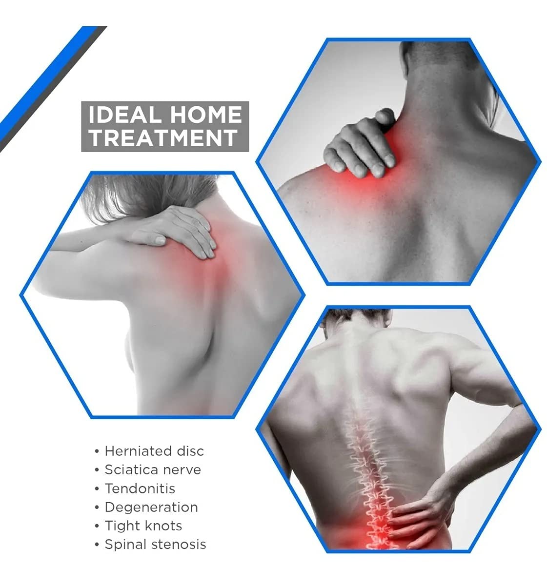 Adjustable Back Stretcher - NUWELLTH