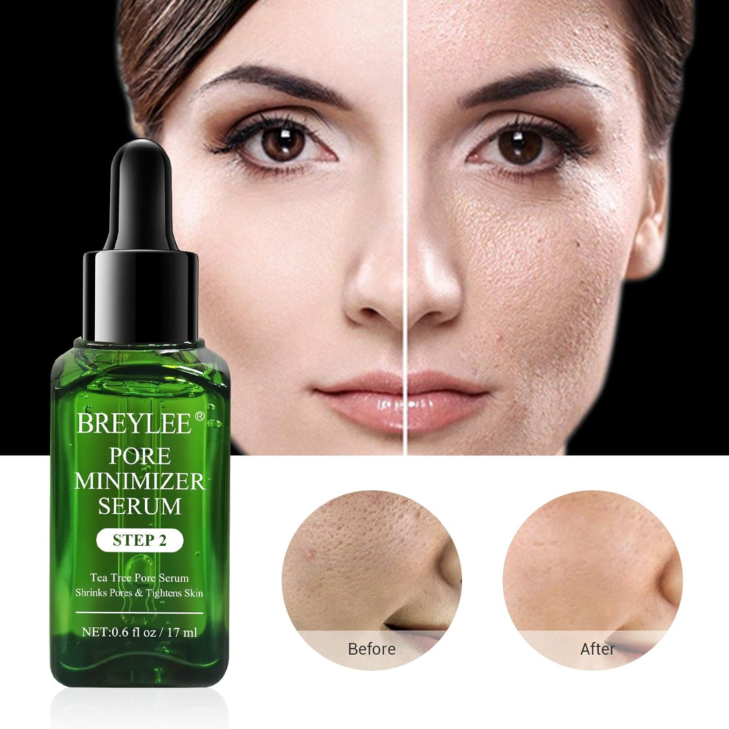 Breylee Tea Tree Pore Minimizer Serum - NUWELLTH