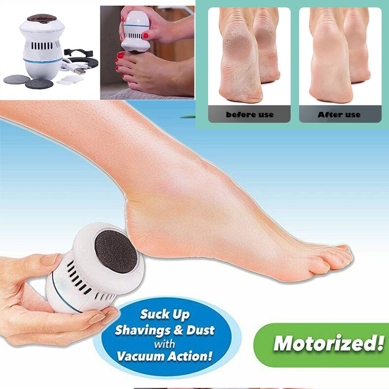 Electric Foot Callus Remover